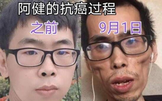 抗癌小伙阿健去世