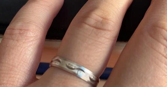 女子退燒后發現銀手鐲變黑了